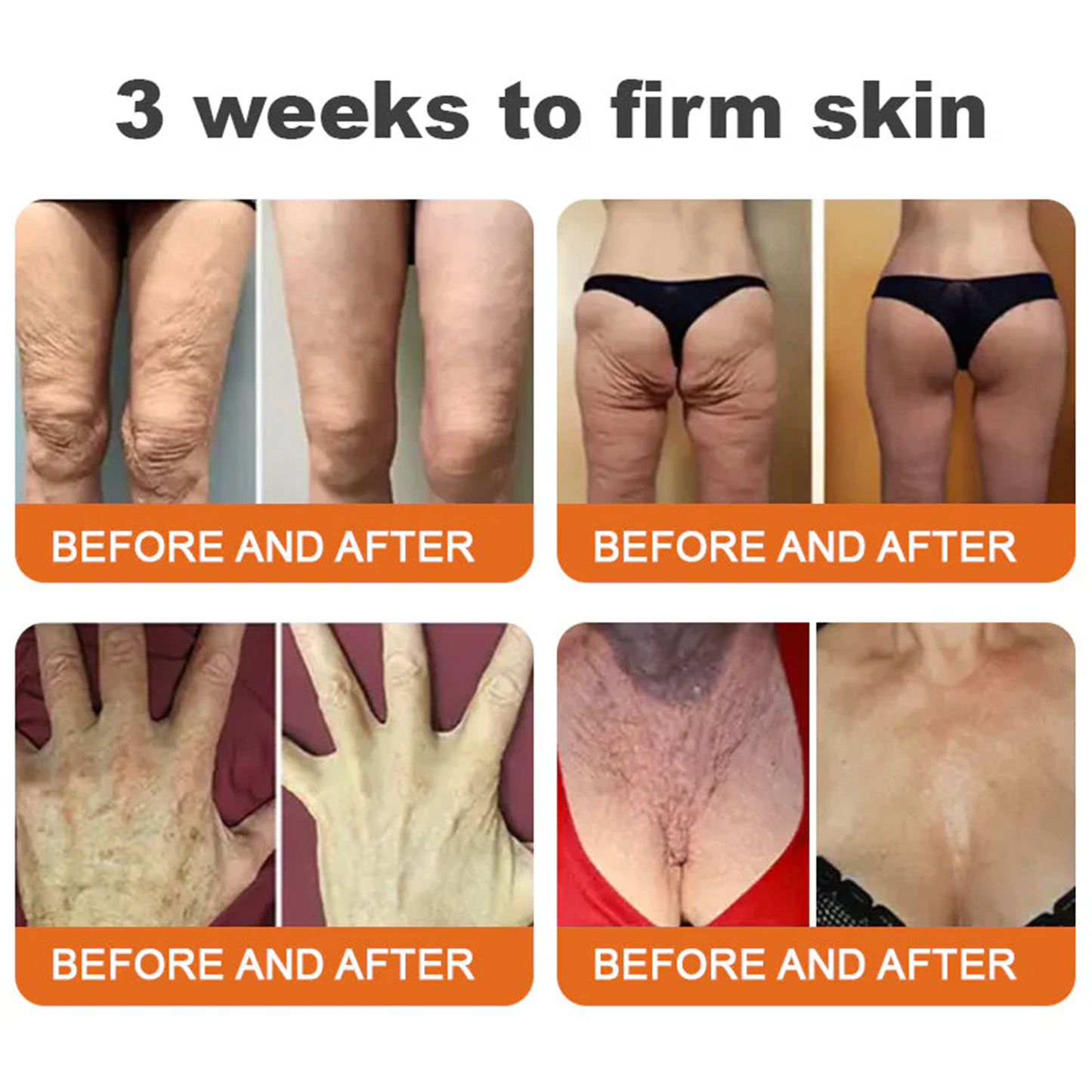 Visible repair starts with consistency! 💛 Get 30% OFF Sabax® for a limited time — most users grab 3–6 jars to lock in lasting results and deeper skin renewal. Don’t wait — healthy, smooth skin starts now! 👉 Shop Sabax® here