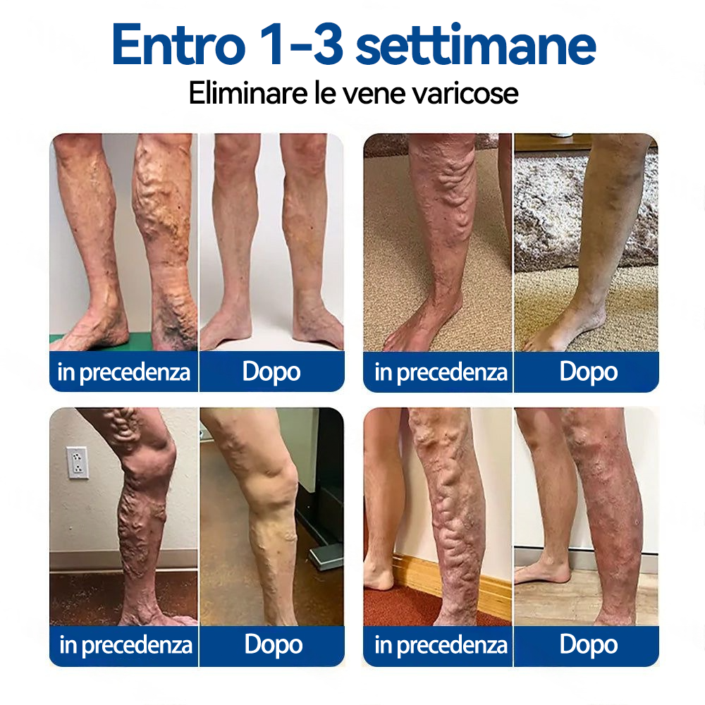 🇮🇹 𝑵𝒆𝒈𝒐𝒛𝒊𝒐 𝑼𝒇𝒇𝒊𝒄𝒊𝒂𝒍𝒆 👨‍⚕️✅✅ 𝑮𝑳𝑶𝑹𝑬𝑵𝑫𝑨® 𝑽𝒆𝒊𝒏𝑻𝒂𝒓𝒈𝒆𝒕 𝑷𝒂𝒕𝒄𝒉 𝒄𝒐𝒏 𝑴𝒊𝒄𝒓𝒐𝒂𝒈𝒉𝒊 ⚡ 𝑺𝒐𝒍𝒍𝒊𝒆𝒗𝒐 𝑰𝒎𝒎𝒆𝒅𝒊𝒂𝒕𝒐, 𝑹𝒊𝒔𝒖𝒍𝒕𝒂𝒕𝒊 𝒂 𝑳𝒖𝒏𝒈𝒐 𝑻𝒆𝒓𝒎𝒊𝒏𝒆