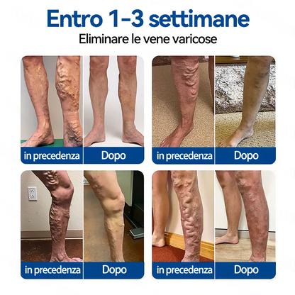 🇮🇹 𝑵𝒆𝒈𝒐𝒛𝒊𝒐 𝑼𝒇𝒇𝒊𝒄𝒊𝒂𝒍𝒆 👨‍⚕️✅✅ 𝑮𝑳𝑶𝑹𝑬𝑵𝑫𝑨® 𝑽𝒆𝒊𝒏𝑻𝒂𝒓𝒈𝒆𝒕 𝑷𝒂𝒕𝒄𝒉 𝒄𝒐𝒏 𝑴𝒊𝒄𝒓𝒐𝒂𝒈𝒉𝒊 ⚡ 𝑺𝒐𝒍𝒍𝒊𝒆𝒗𝒐 𝑰𝒎𝒎𝒆𝒅𝒊𝒂𝒕𝒐, 𝑹𝒊𝒔𝒖𝒍𝒕𝒂𝒕𝒊 𝒂 𝑳𝒖𝒏𝒈𝒐 𝑻𝒆𝒓𝒎𝒊𝒏𝒆