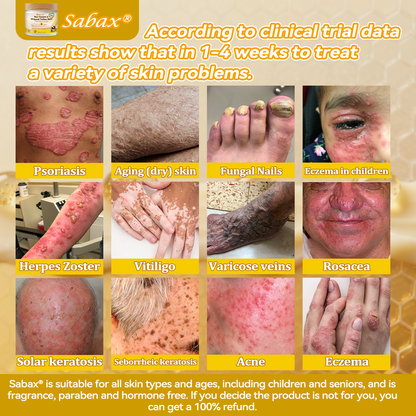 Visible repair starts with consistency! 💛 Get 30% OFF Sabax® for a limited time — most users grab 3–6 jars to lock in lasting results and deeper skin renewal. Don’t wait — healthy, smooth skin starts now! 👉 Shop Sabax® here