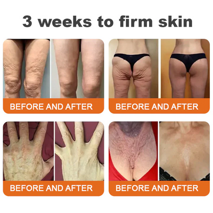 Visible repair starts with consistency! 💛 Get 30% OFF Sabax® for a limited time — most users grab 3–6 jars to lock in lasting results and deeper skin renewal. Don’t wait — healthy, smooth skin starts now! 👉 Shop Sabax® here